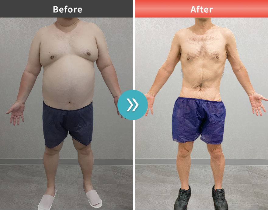 木村昌夫様 施術前